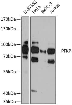 PFKP Antibody