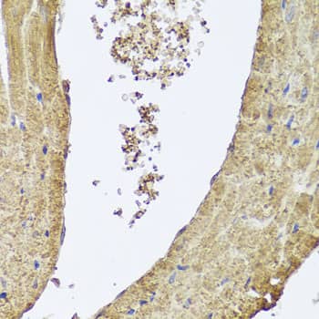 PIK3C2A Antibody