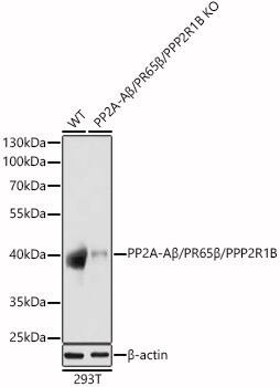 PPP2R1B Antibody
