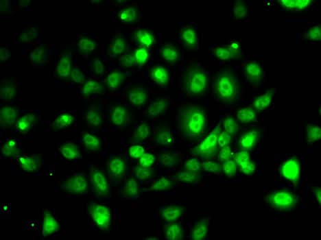 PPP2R1B Antibody