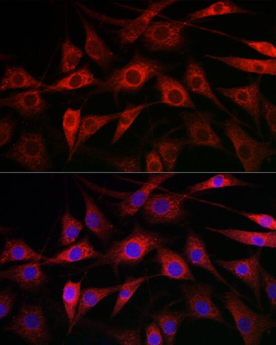 Cytochrome P450 1A1 Antibody