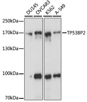 53BP2 Antibody