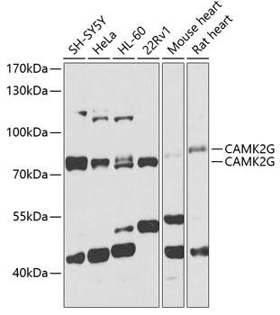 CaM Kinase II gamma Antibody