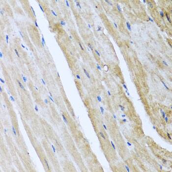 CaM Kinase II gamma Antibody