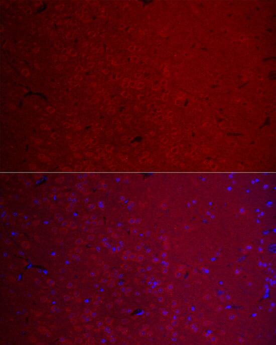 CaM Kinase II gamma Antibody