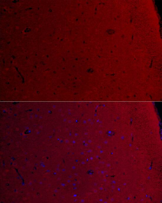 CaM Kinase II gamma Antibody