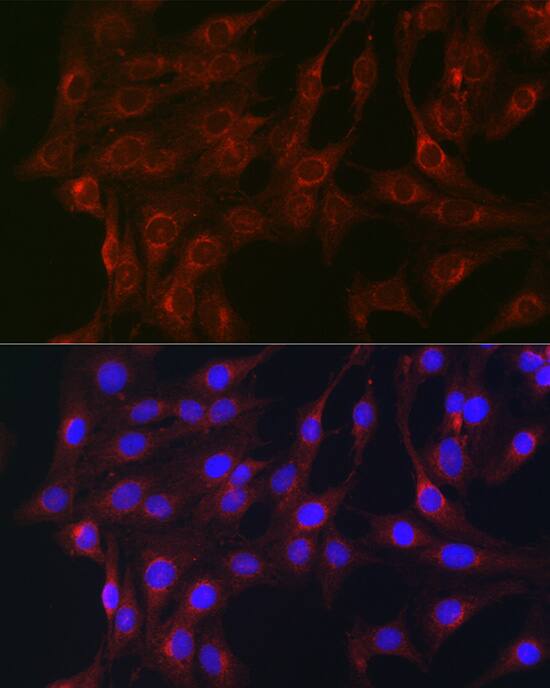 RAB1B Antibody