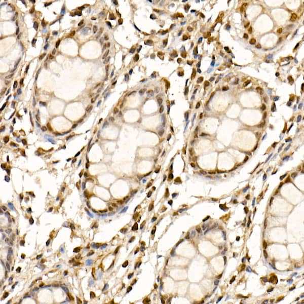 Cullin 1 Antibody