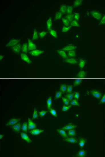 TXNL1 Antibody