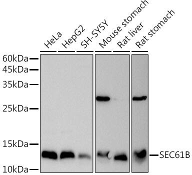 SEC61B Antibody