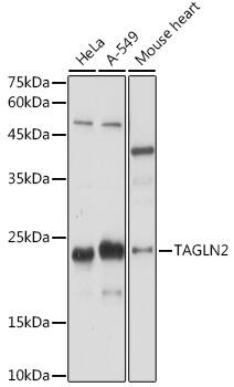 transgelin 2 Antibody