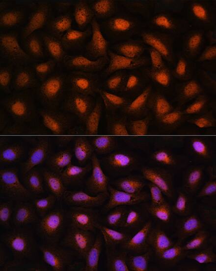 CTBP2 Antibody