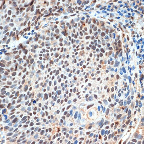 JMJD1B Antibody