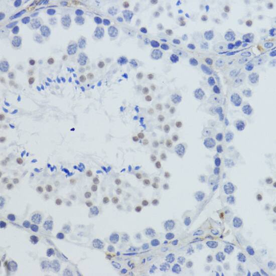 H4 Clustered Histone 1 [Trimethyl Lys20] Antibody