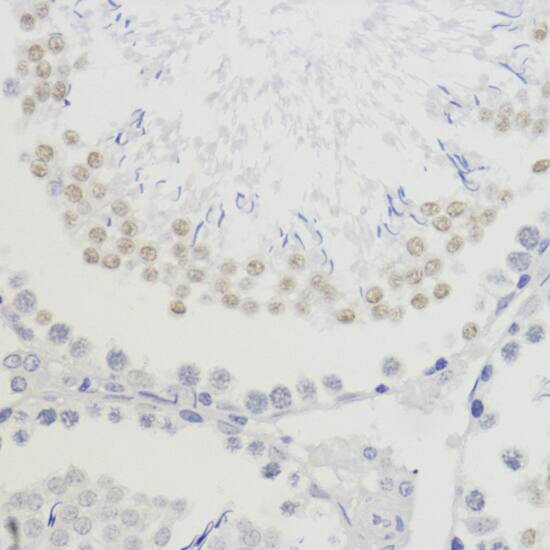 H4 Clustered Histone 1 [Trimethyl Lys20] Antibody