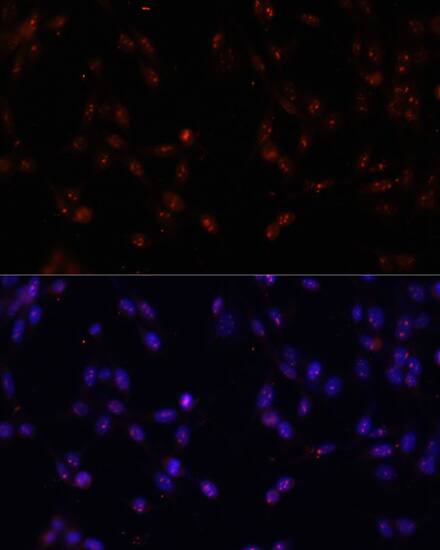 ILF3 Antibody