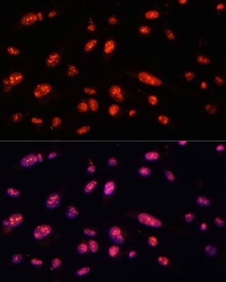 ILF3 Antibody