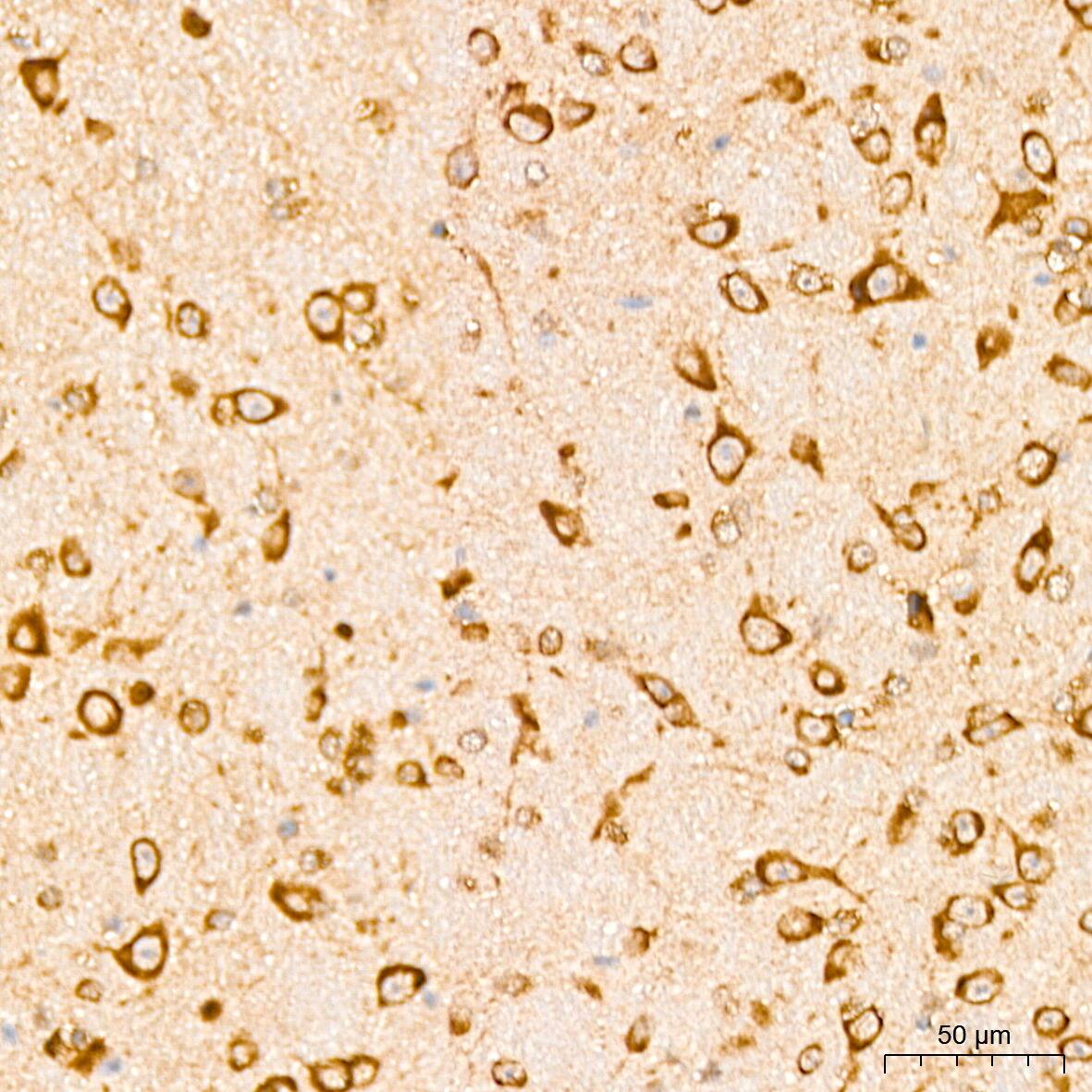 EEF1D Antibody