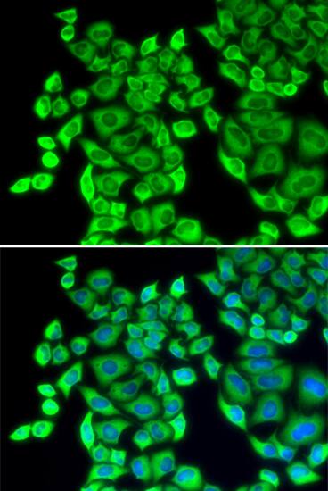 EEF1D Antibody