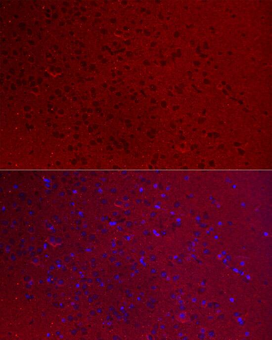 GO Protein alpha Antibody