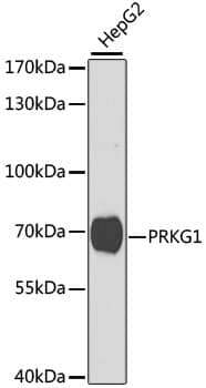 cGK1/PRKG1 Antibody