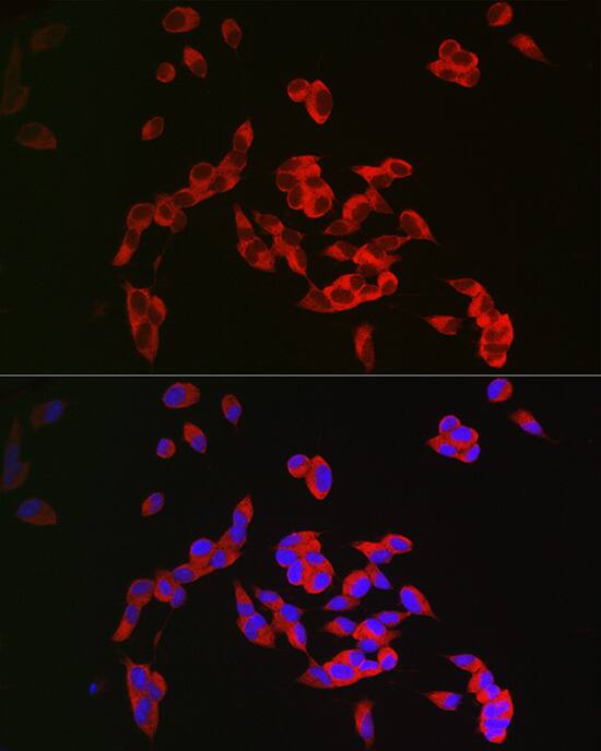 CRMP1 Antibody