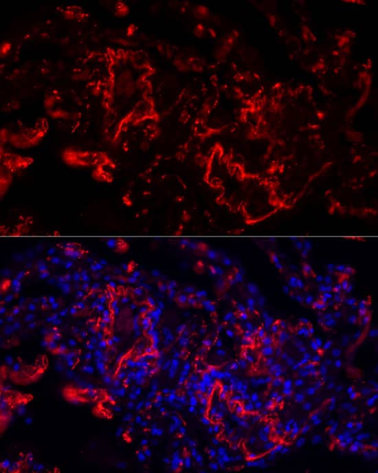 Elastin Antibody