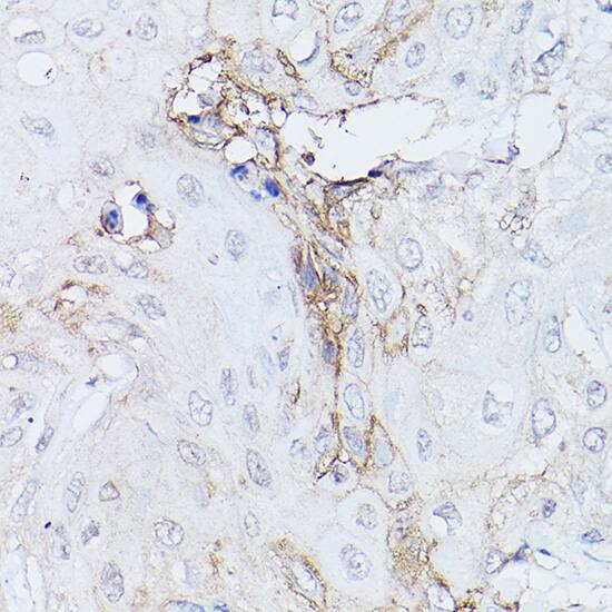 GNA11 Antibody