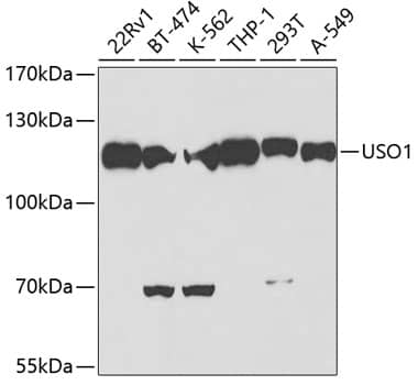 VDP p115 Antibody