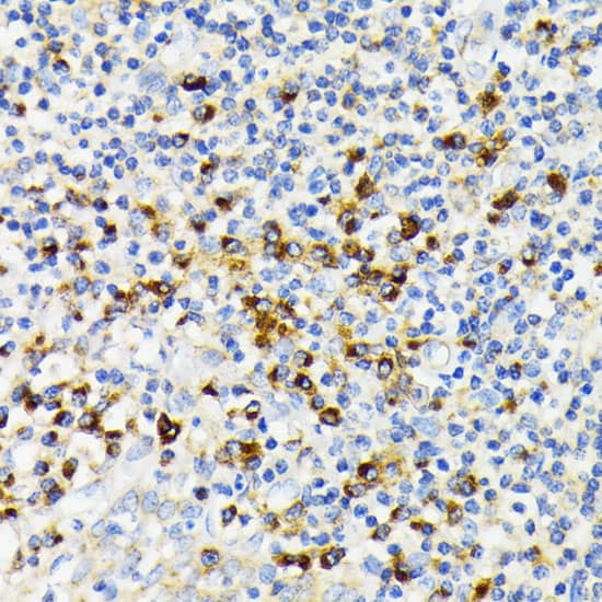 VDP p115 Antibody