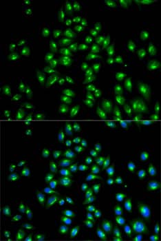 VDP p115 Antibody