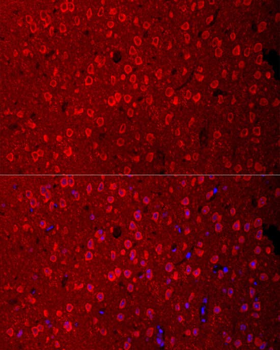 EAAT3 Antibody