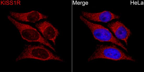 KiSS1R/GPR54 Antibody
