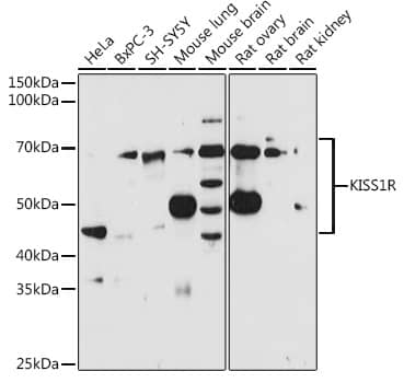 KiSS1R/GPR54 Antibody