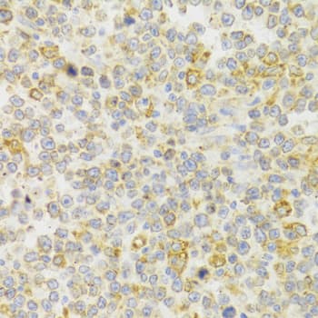 KiSS1R/GPR54 Antibody