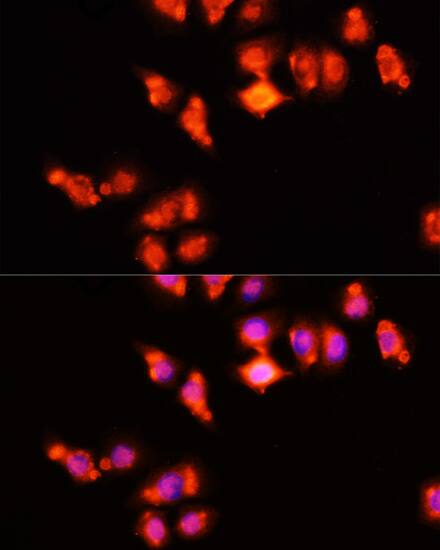 HOXA11 Antibody