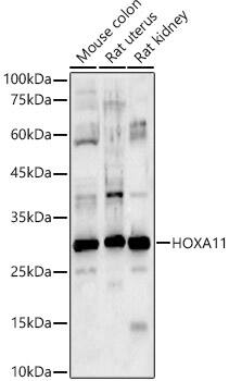 HOXA11 Antibody