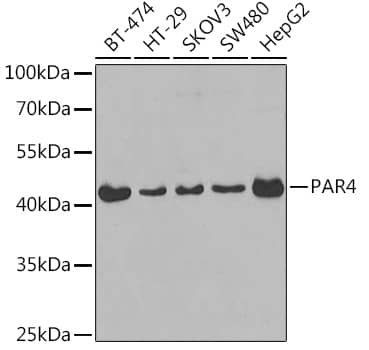 PAWR / PAR4 Antibody