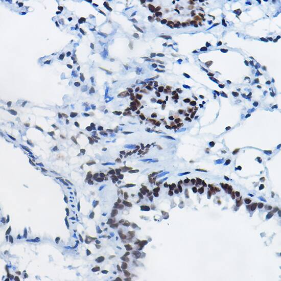 H4 Clustered Histone 1 [Monomethyl Arg3] Antibody