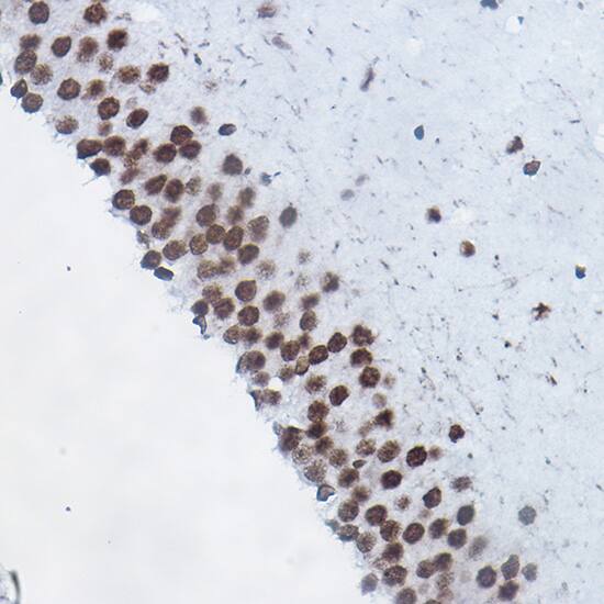 H4 Clustered Histone 1 [Monomethyl Arg3] Antibody