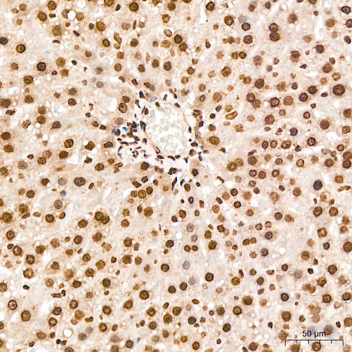 H4 Clustered Histone 1 [Sym-dimethyl Arg3] Antibody