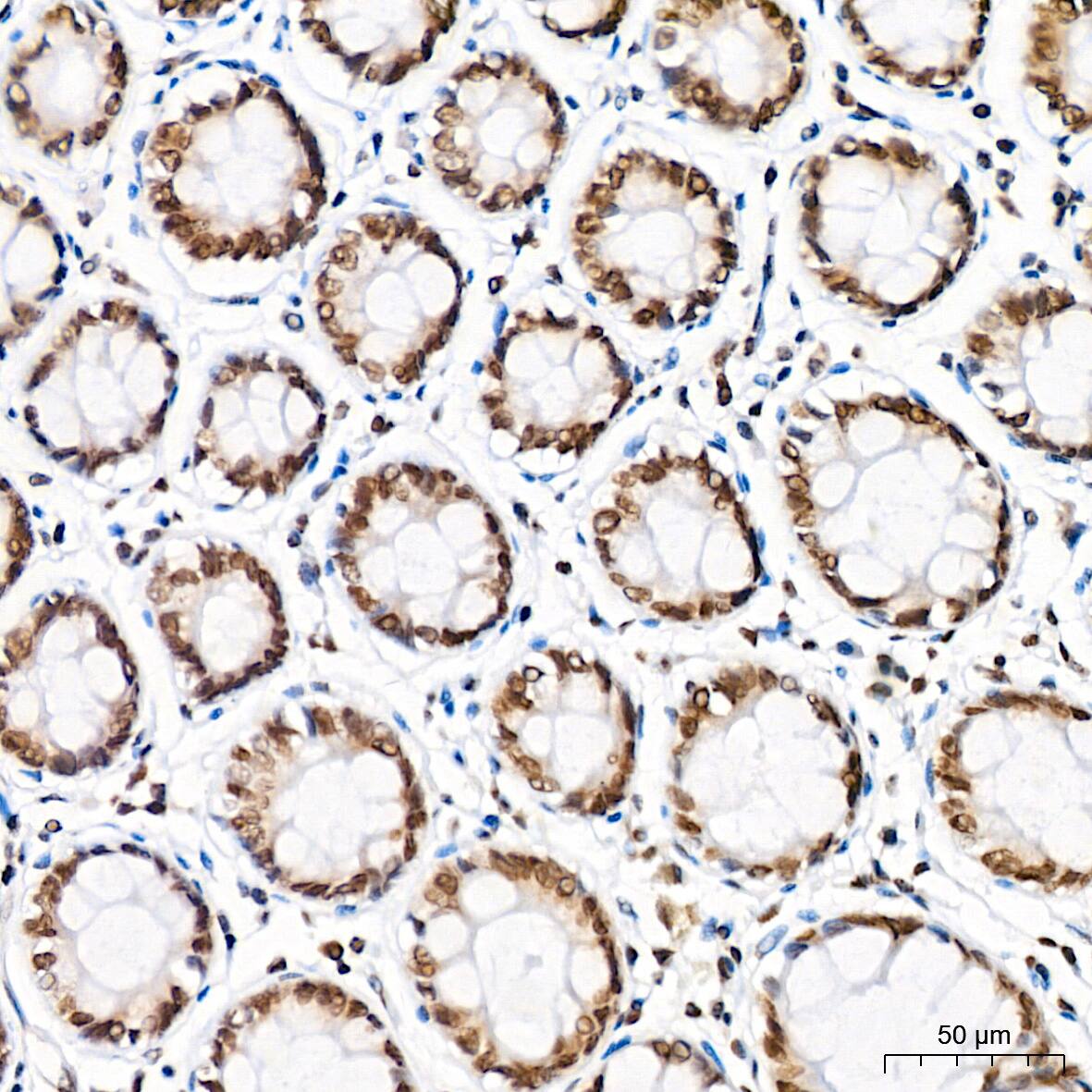 H4 Clustered Histone 1 [Sym-dimethyl Arg3] Antibody