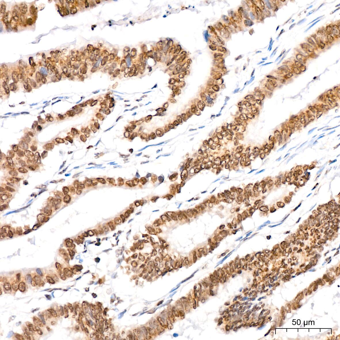 H4 Clustered Histone 1 [Sym-dimethyl Arg3] Antibody