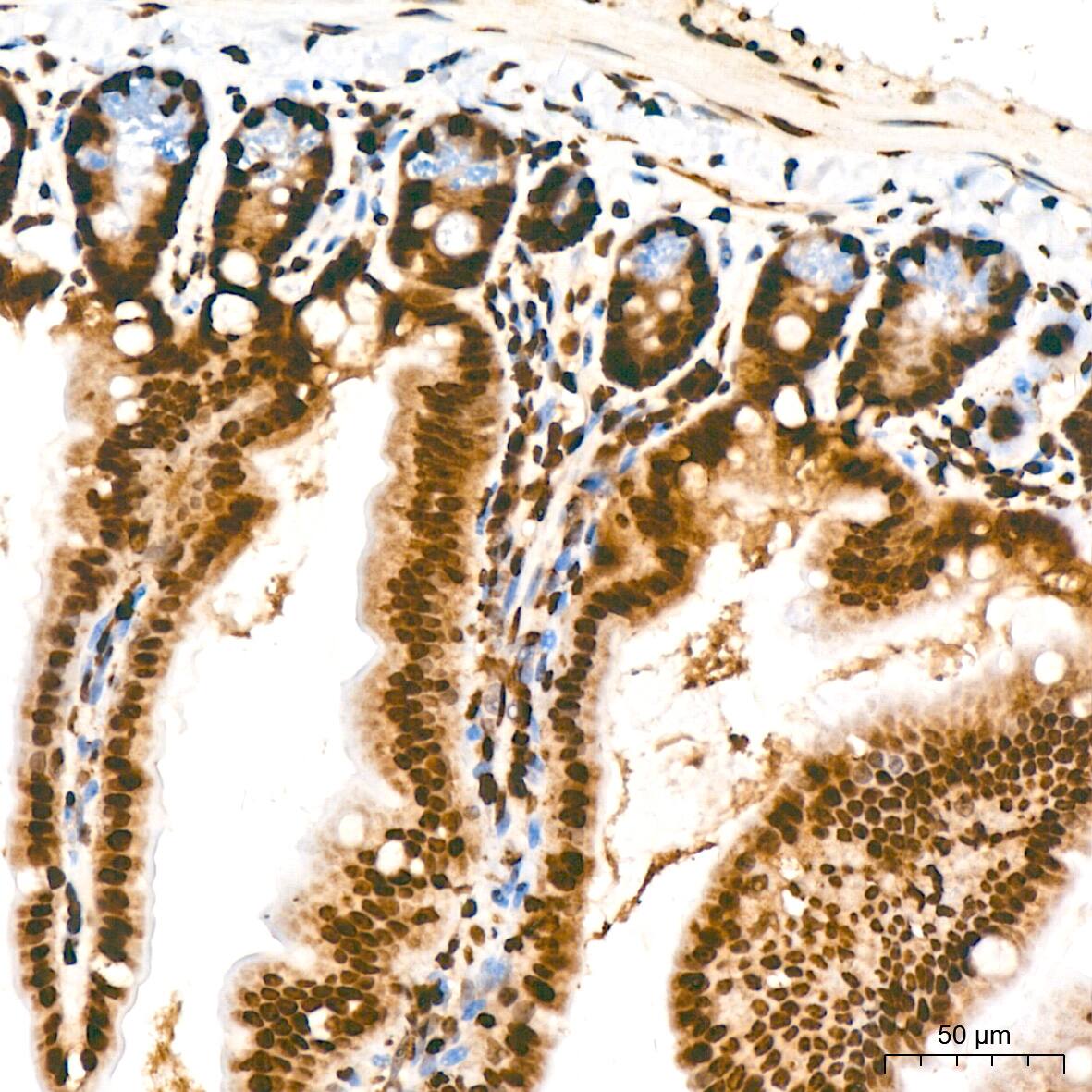 H4 Clustered Histone 1 [Sym-dimethyl Arg3] Antibody