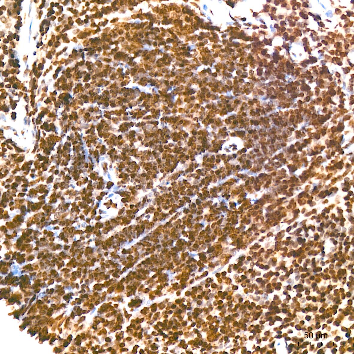 H4 Clustered Histone 1 [Sym-dimethyl Arg3] Antibody