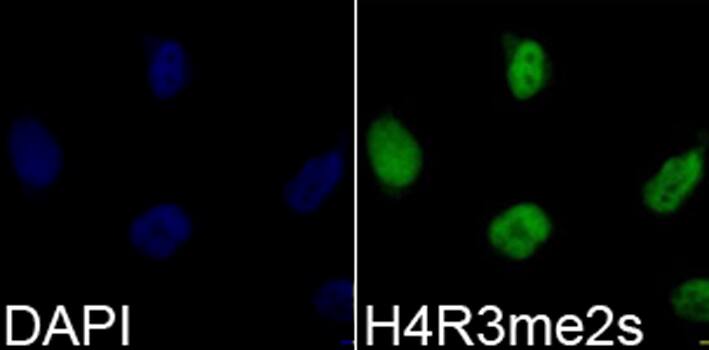 H4 Clustered Histone 1 [Sym-dimethyl Arg3] Antibody