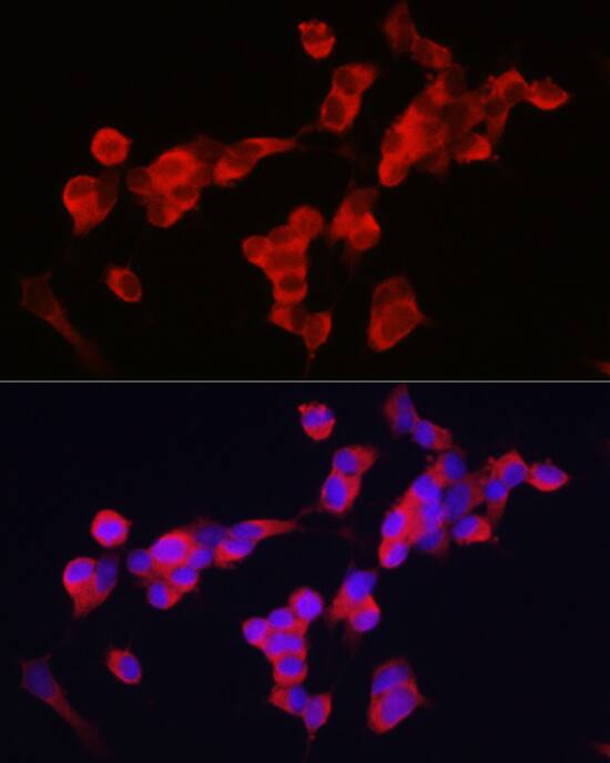 Kinesin 5A Antibody