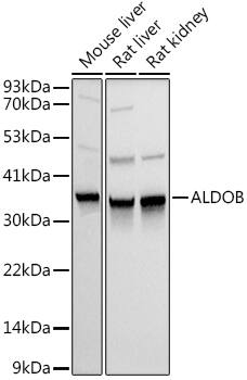 Aldolase B Antibody