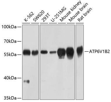 ATP6V1B2 Antibody