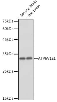 ATP6V1E1 Antibody